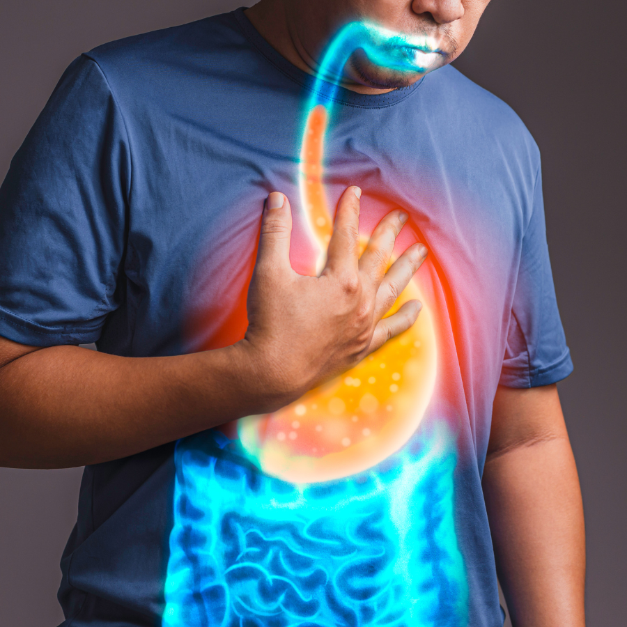 Acid reflux or heartburn